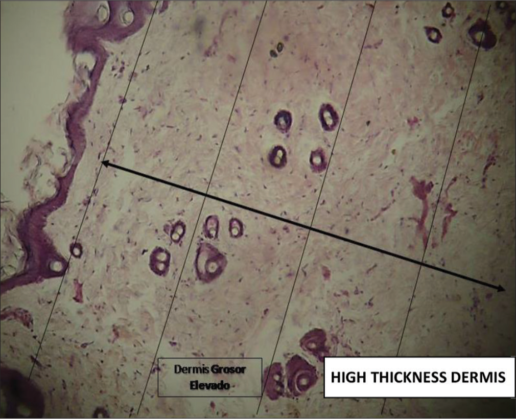 Photomicrograph hematoxylin and eosin-stained histological section of skin (×40). The oblique black arrow crossing the histological preparation shows the size or thickness of the dermis in the experimental group (it occupies 4/4 of the field).