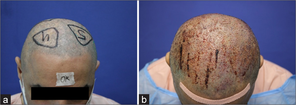 (a) Pre-operative pictures. (b) Immediate post-operative pictures.